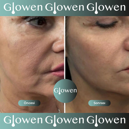 Glowen - Mikro İnfüzyon Serum